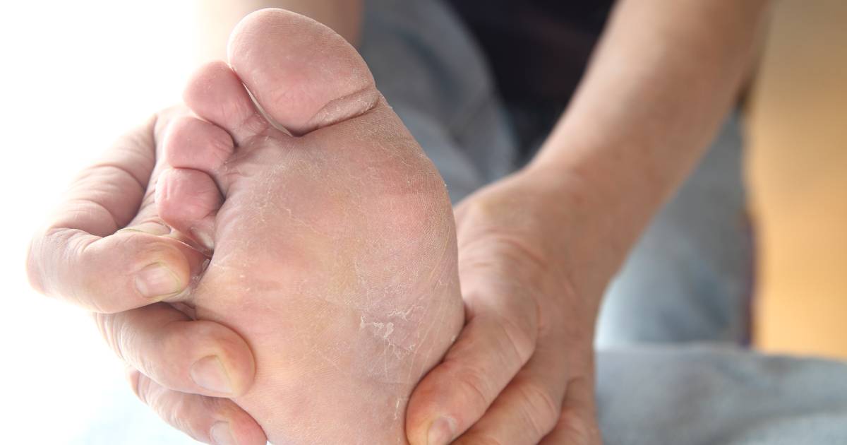 Athletes Foot