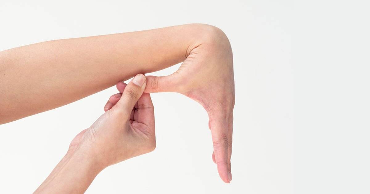 Hypermobility