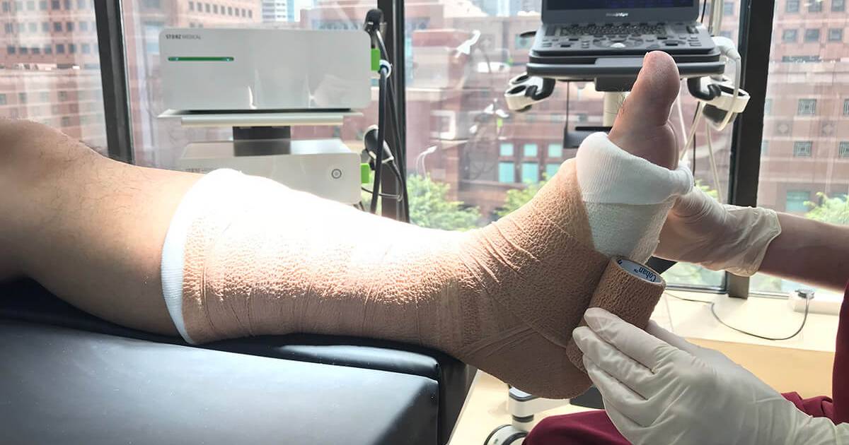 Wound Dressing