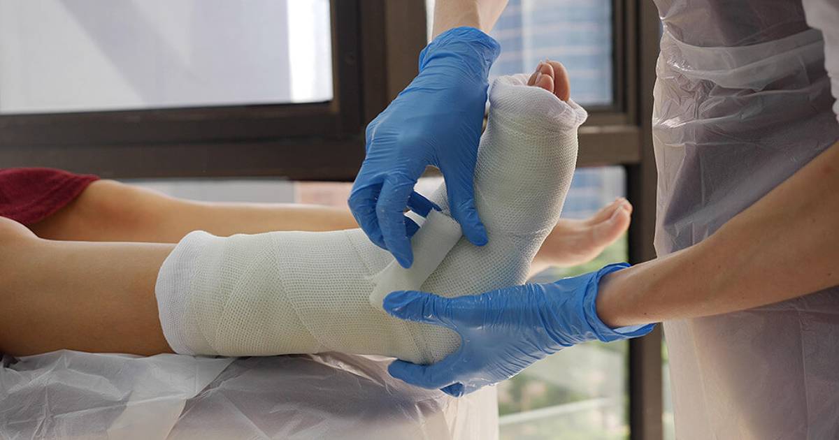 Casting Foot