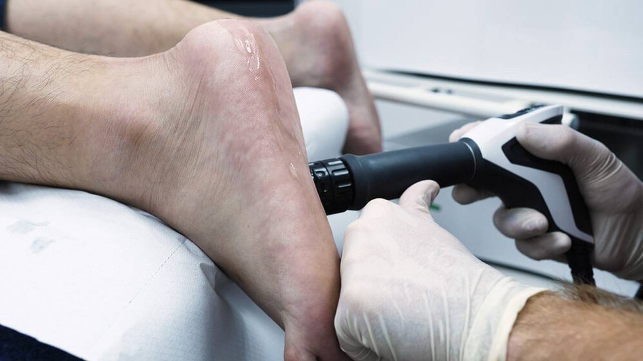 Plantar Fasciopathy Shockwave Therapy
