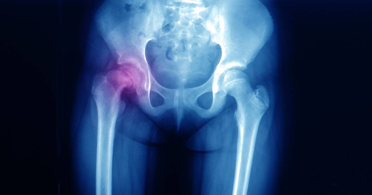 Paediatric Hip Pain