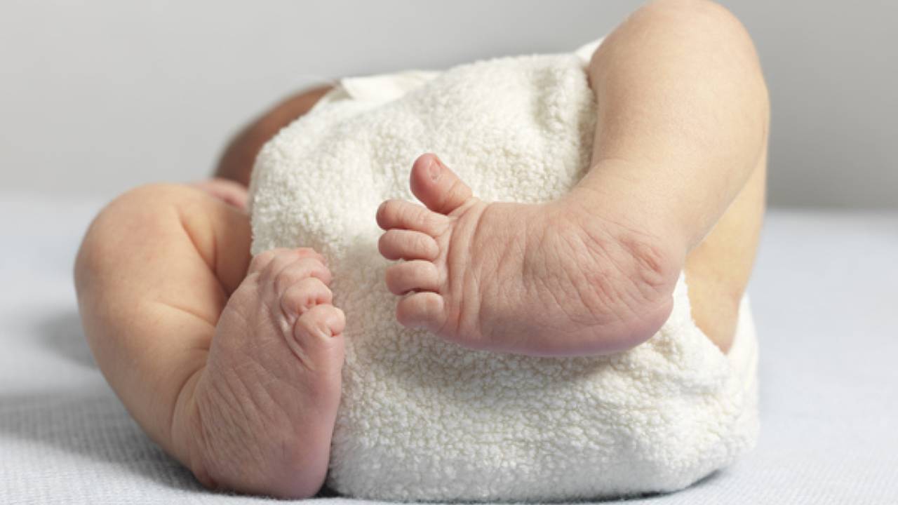 Club Foot Child