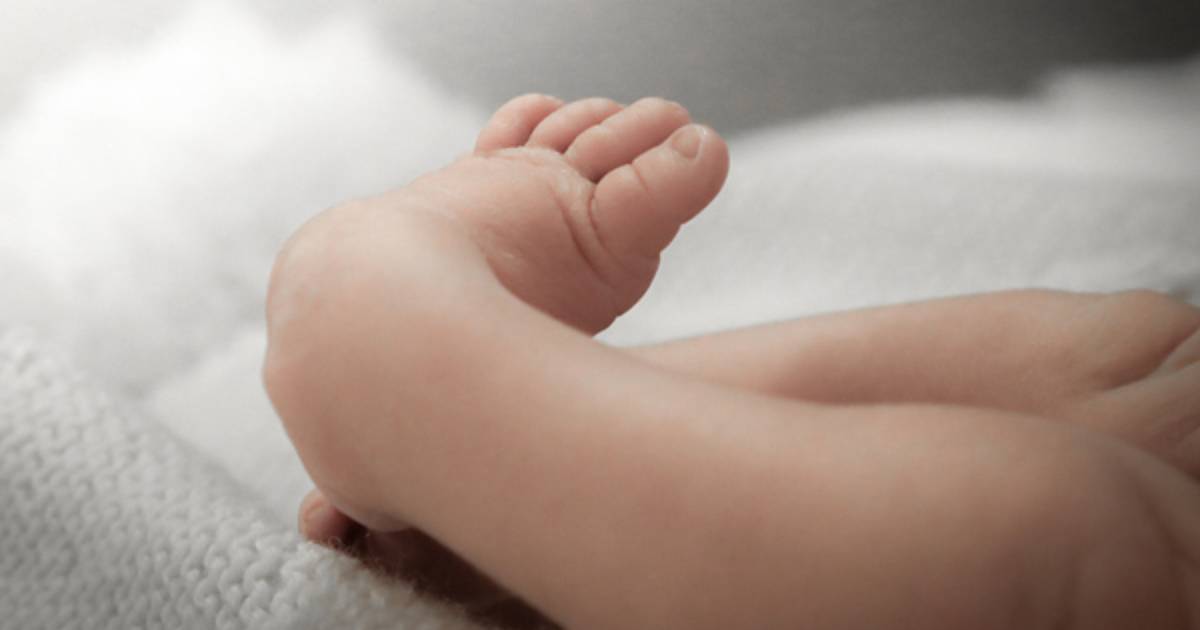 Club Foot Child