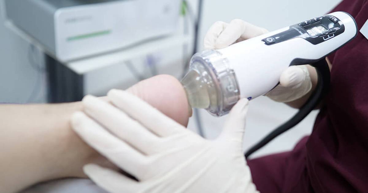 Defocused shockwave | East Coast Podiatry