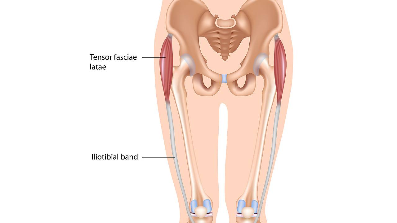 Iliotibial band syndrome