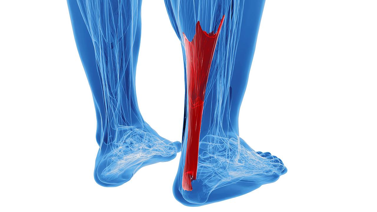 ECPC | Achilles Tendionopathy Foot Model