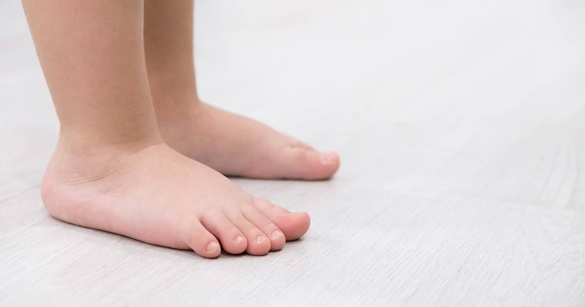 Flat Foot Child