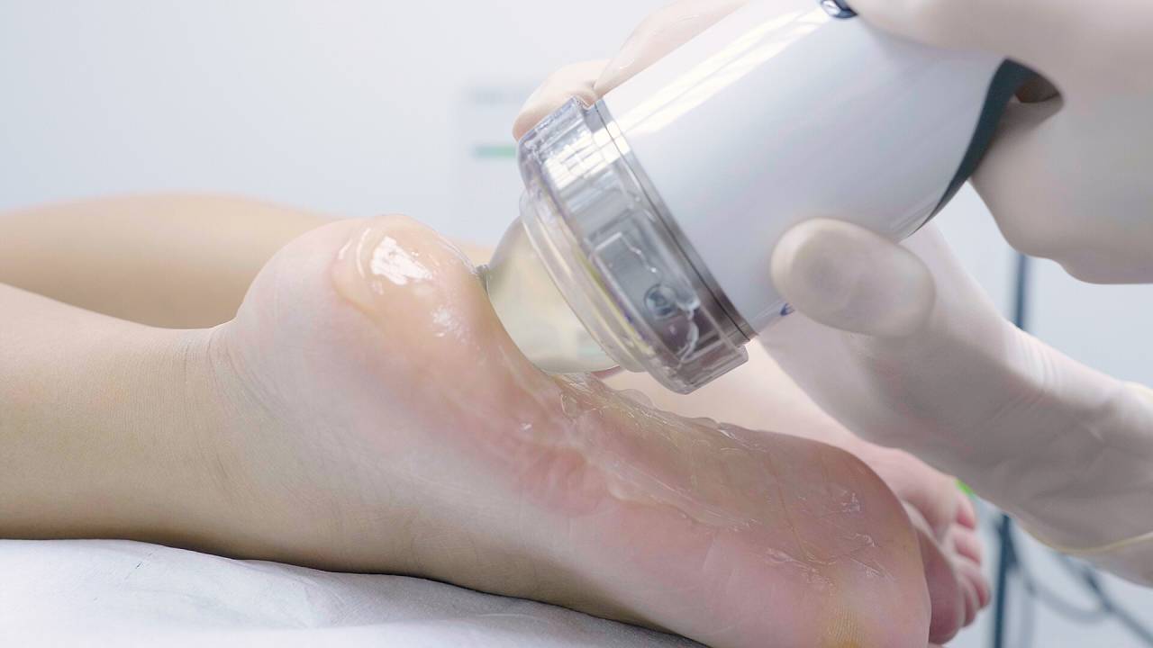 Extracorporeal Shockwave Therapy (ESWT)