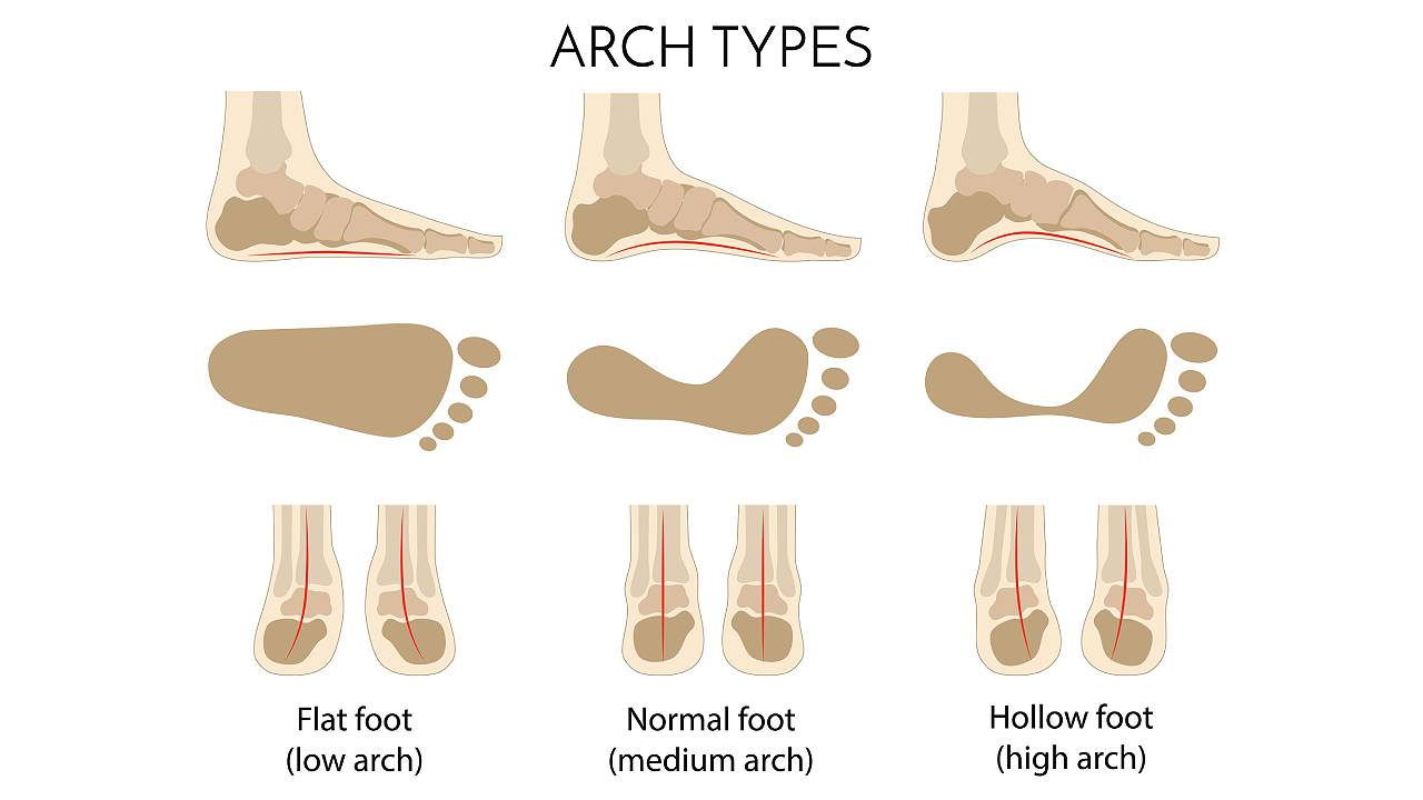 Arch types