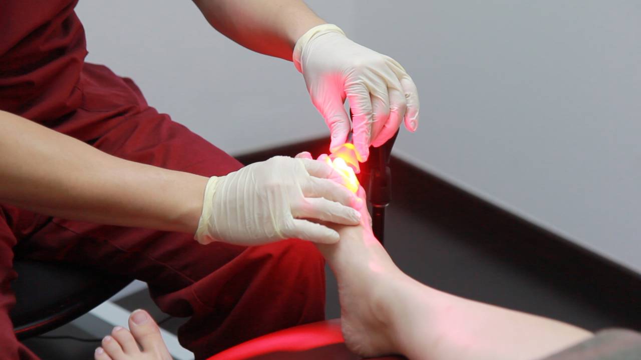 Fungal Nail Treatment