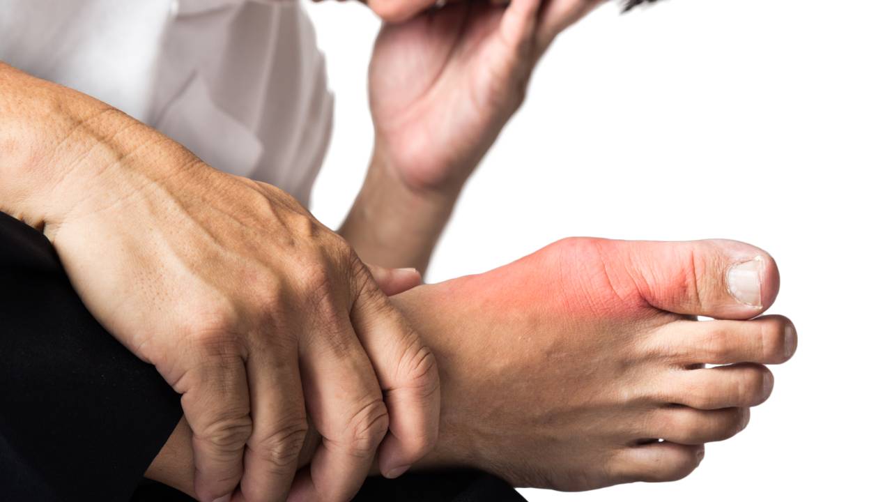 Gout Attack