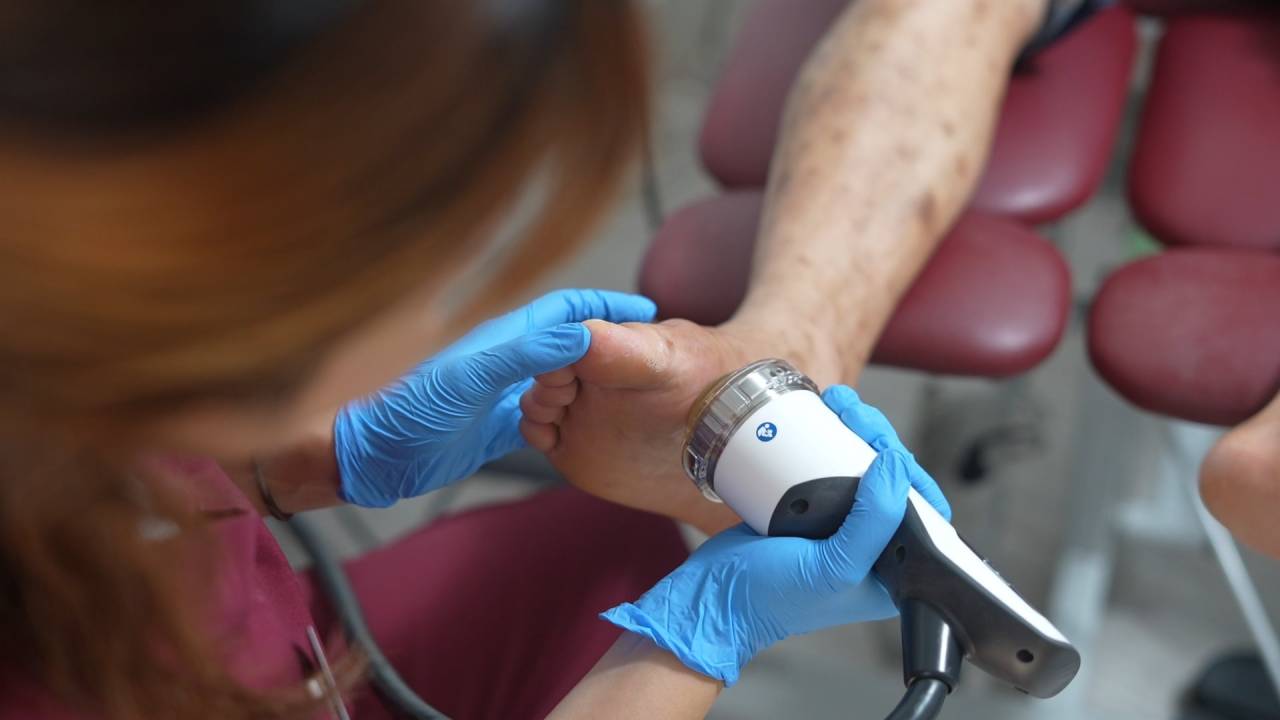 Gout Treatment